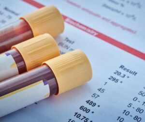 Blood Test-Guided Diet Reduces IBS Symptoms