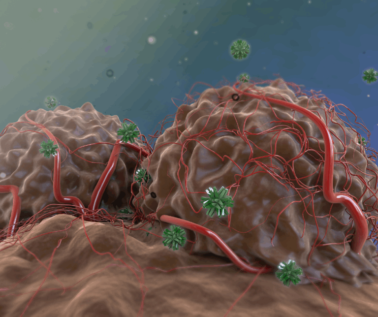 glioblastoma tumor illustration