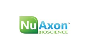 The Case of the Man with “Unmasked” Premature Ventricular Contractions