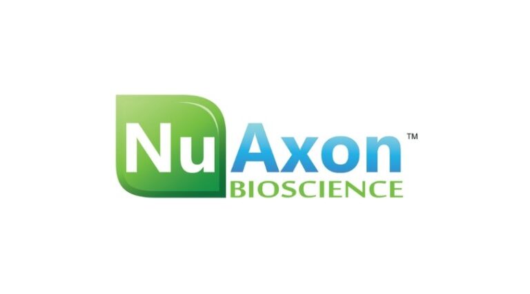 The Case of the Man with “Unmasked” Premature Ventricular Contractions