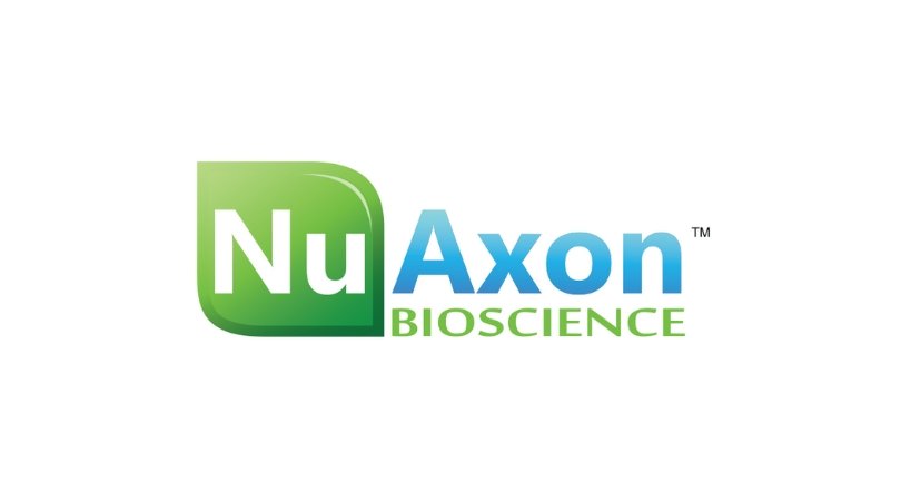 The Case of the Man with “Unmasked” Premature Ventricular Contractions